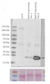 BAR | Phosphinothricin N-acetyltransferase (170-183)